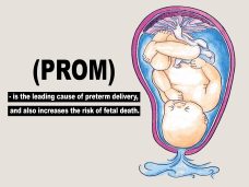 Premature Rupture of Membranes (PROM)