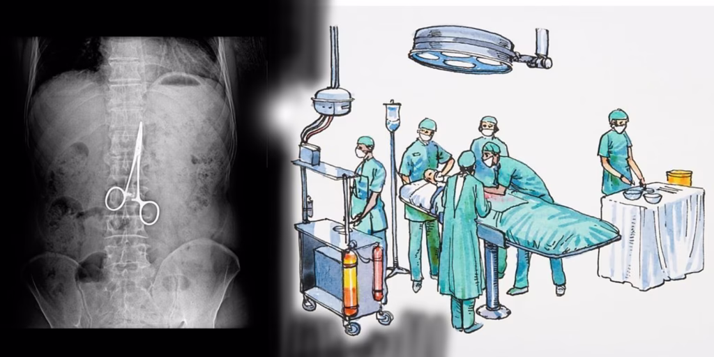 Can You Sue for Foreign Objects Left Behind During Surgery? 11 Can You Sue for Foreign Objects Left Behind During Surgery?