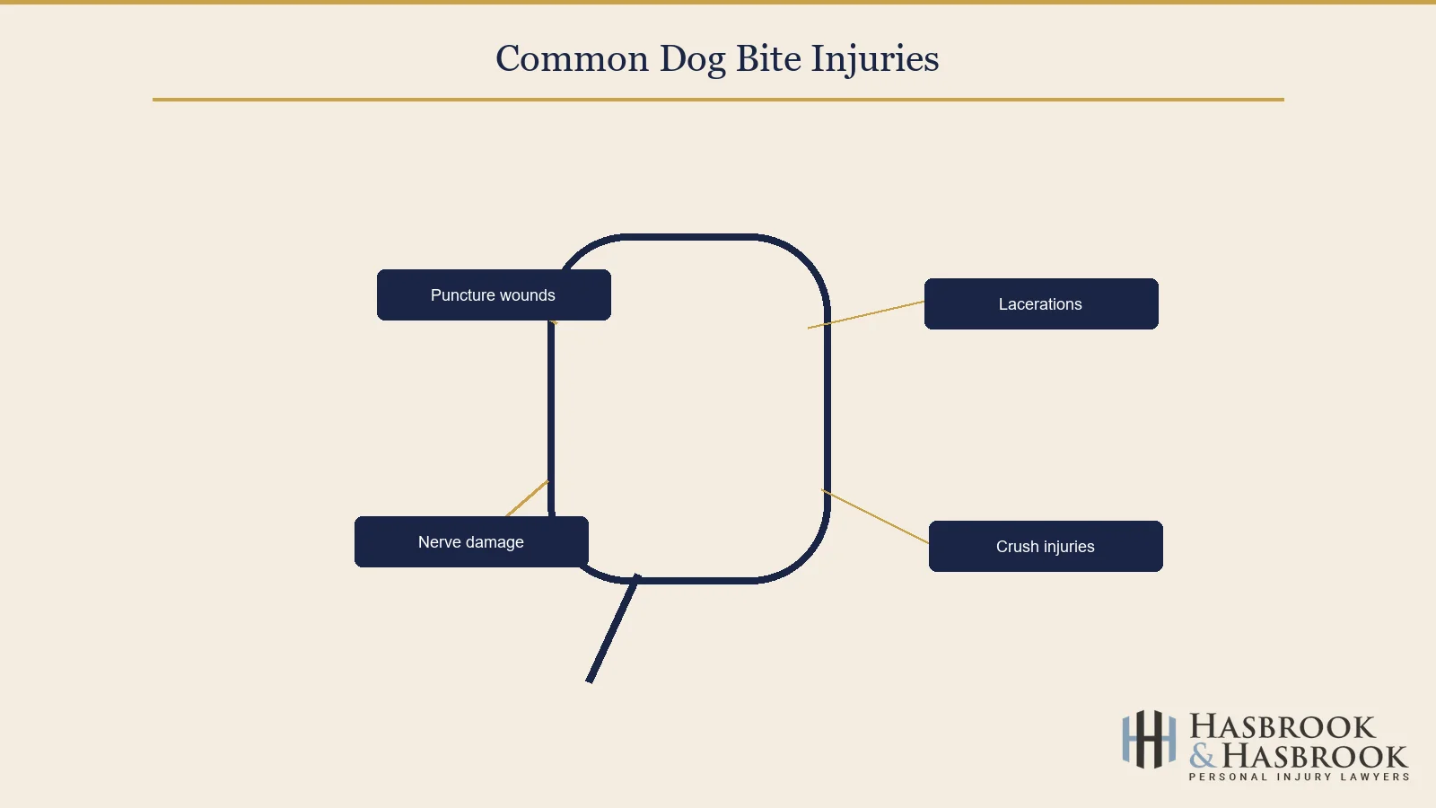 Common dog bite injuries medical illustration
